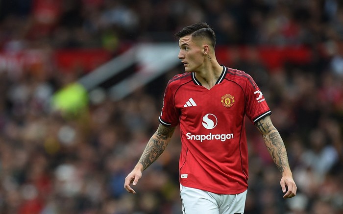 **Berbatov Memoles Benjamin Sesko: Mentor Baru di Manchester United**